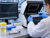 Urine PCR Test for UTI: Bacterial DNA, Resistance Genes, and Result Meaning Learn how urine PCR testing detects UTI bacterial DNA and resistance genes, how it compares with urine culture, and what positive, negative, or multi-organism results mean.