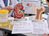 Understand what a urine phosphorus test measures, why levels may be high or low, how kidney phosphate wasting is assessed, and how results relate to bone-mineral balance and kidney stones.