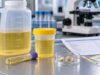 A urine phosphorus test helps assess mineral balance, 24-hour phosphorus results, and calcium phosphate stone risk alongside urine pH, calcium, citrate, and volume.