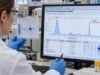 Urine Protein Electrophoresis (UPEP) Test: Protein Types, M Protein, and Myeloma Screening Understand UPEP results, M-spikes, monoclonal light chains, urine immunofixation, myeloma screening, kidney effects, 24-hour collection, and abnormal-result follow-up.