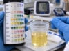 Urine Protein Test: High Protein, Proteinuria, Kidney Disease, and Causes Learn what a high urine protein test means, how proteinuria is measured, common kidney and temporary causes, key ranges, and when repeat testing or specialist care is needed.
