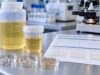 A urine supersaturation test estimates calcium oxalate, calcium phosphate, and uric acid crystallization risk and shows how pH, volume, and urine chemistry interact.