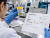 Urine Total Protein Test: High Levels, Kidney Disease, Proteinuria, and Meaning Understand urine total protein results, including normal values, high-protein causes, differences from albumin testing, spot versus 24-hour samples, and kidney follow-up.