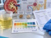 Learn how to interpret urine pH, including acidic and alkaline results, kidney stone patterns, UTI clues, renal tubular acidosis, normal ranges, and when follow-up testing matters.