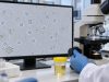 White Blood Cells in Urine Test: Pyuria, UTI, Inflammation, and Meaning Understand white blood cells in urine, pyuria ranges, UTI and sterile-pyuria causes, how WBCs relate to leukocyte esterase and nitrite, and when follow-up is needed.