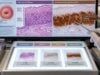 p16 IHC Test for Cervical Cancer: HPV-Related Tumor Marker, Dysplasia, and Positive Staining Learn what p16 IHC means in cervical biopsies, how block-positive staining supports HPV-related HSIL, and how p16 differs from HPV testing and p16/Ki-67 dual stain.